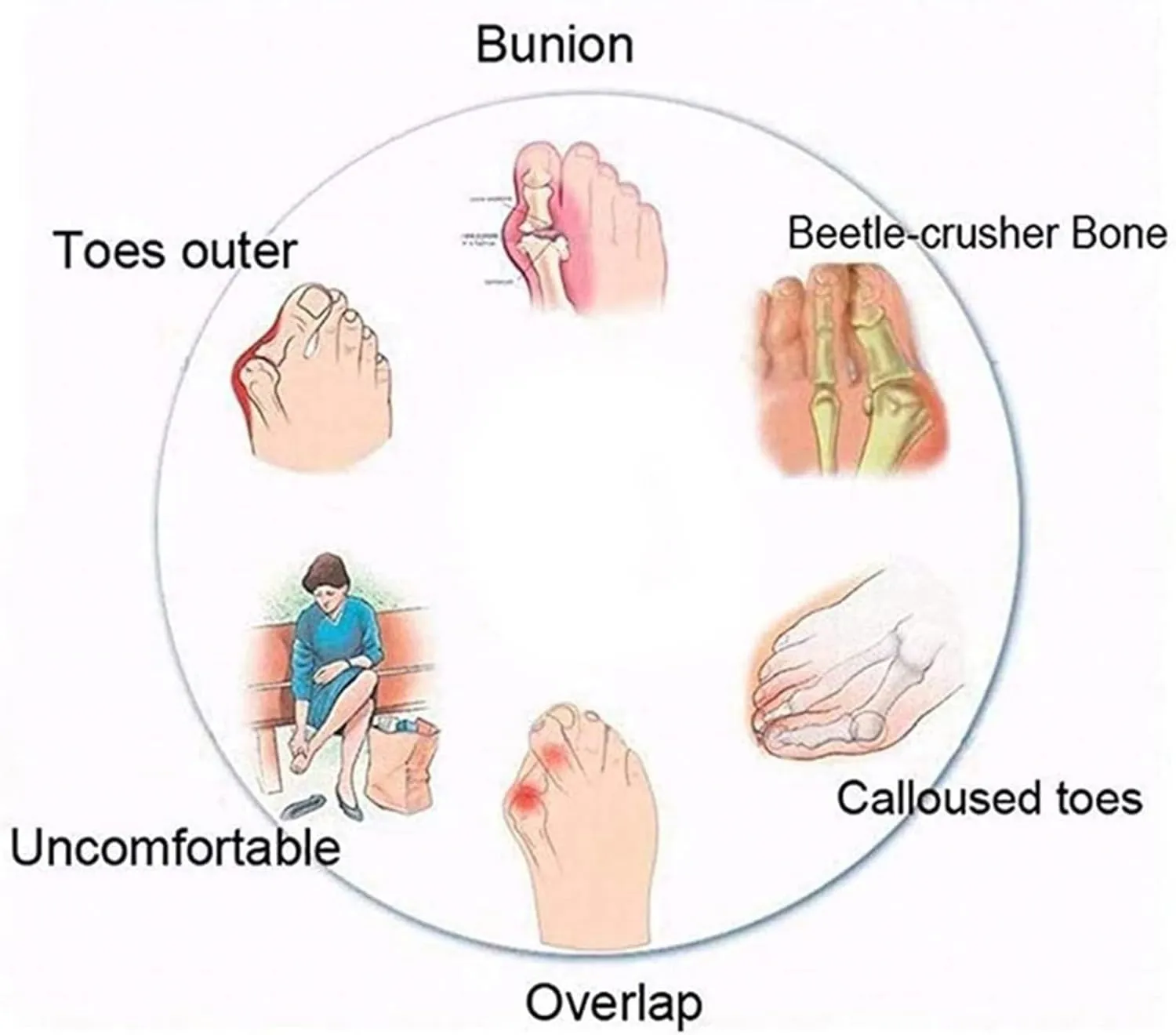 Comfy Flat Leather Sandals Bunion Corrector for Women Big Toe, Summer Non- Slip Sandals for Women Bunion Relief